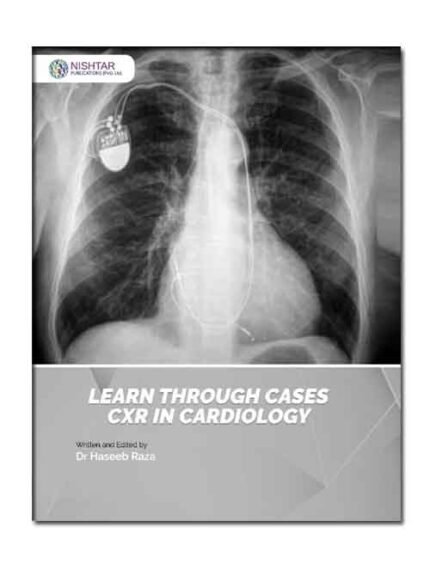 Learn Through Cases CXR in Cardiology by Dr. Haseeb Raza