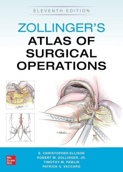 Zollinger's Atlas of Surgical Operations 11th Edition