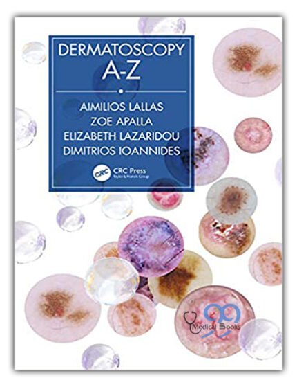 Dermatoscopy A-Z 1st Edition