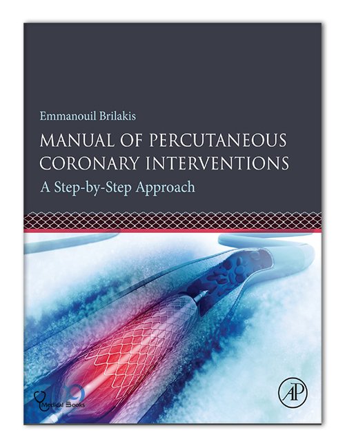 Manual of Percutaneous Coronary Interventions