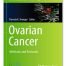 Ovarian Cancer