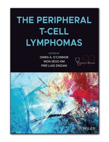 The Peripheral T-Cell Lymphomas