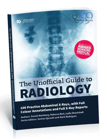 The Unofficial Guide to Radiology 2nd Edition