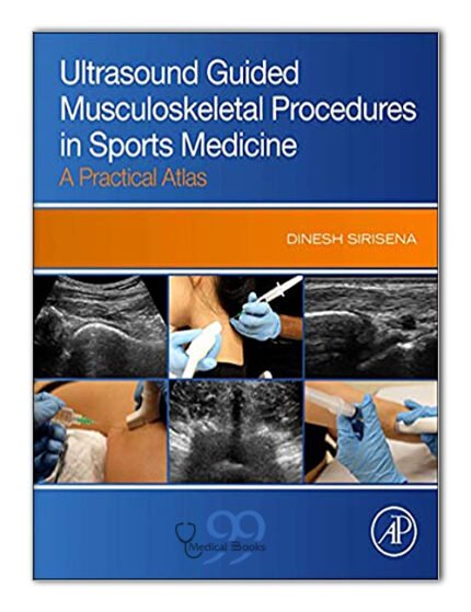 Ultrasound Guided Musculoskeletal Procedures in Sports Medicine