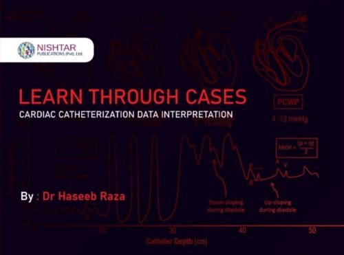 Learn Through Cases Cardiac Catheterization Data Interpretation Dr. Haseeb Raza