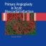 Primary Angioplasty in Acute Myocardial Infarction