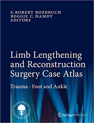Limb Lengthening and Reconstruction Surgery Case Atlas