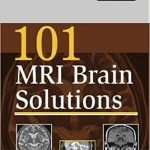 101 MRI Brain Solutions