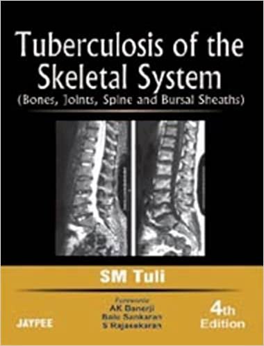Tuberculosis of the Skeletal System Bones Joints Spine and Bursal Sheaths 4th Ed