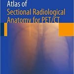 Atlas of Sectional Radiological Anatomy for PET CT