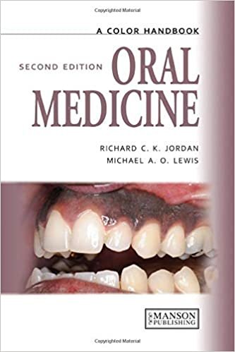 Oral Medicine A Color Handbook 2nd Ed