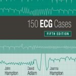 150 ECG Cases 5th Ed By John R Hampton