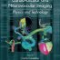 Cardiovascular and Neurovascular Imaging Physics and Technology