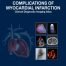 Complications of Myocardial Infarction Clinical Diagnostic Imaging Atlas