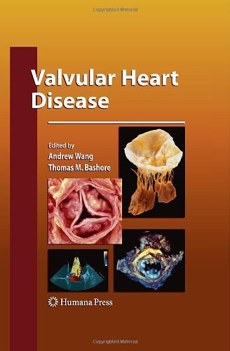 Valvular Heart Disease Contemporary Cardiology