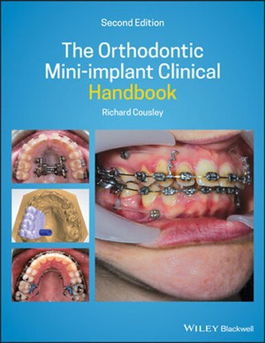 The Orthodontic Mini implant Clinical Handbook 2nd Edition