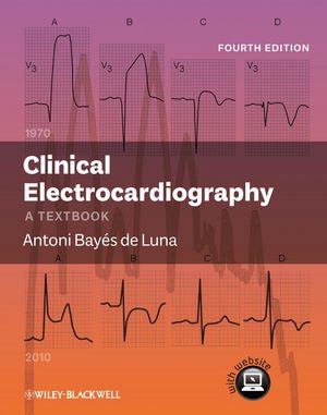 Clinical Electrocardiography A Textbook 4th Ed