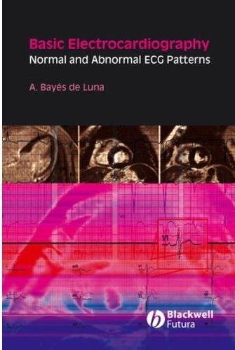 Basic Electrocardiography Normal and Abnormal ECG Patterns deLuna