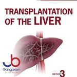 Transplantation of the Liver 3rd Edition