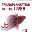 Transplantation of the Liver 3rd Edition