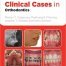 Clinical Cases in Orthodontics 1st Edition