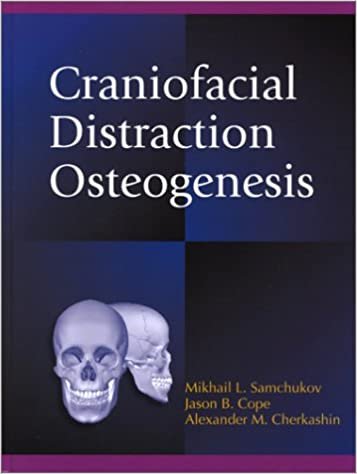 Craniofacial Distraction Osteogenesis 1st Edition