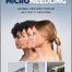 Microneedling: Global Perspectives in Aesthetic Medicine 1st Edition