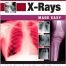 On-Call X-Rays Made Easy 1st Edition