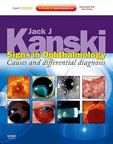 Signs in Ophthalmology: Causes and Differential Diagnosis