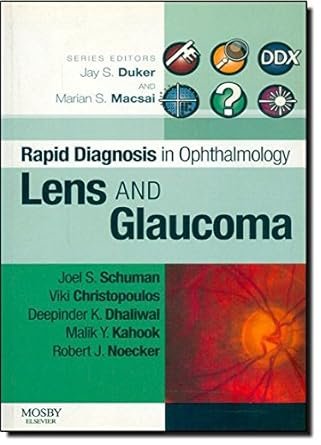 Lens and Glaucoma (Rapid Diagnoses in Ophthalmology Series)