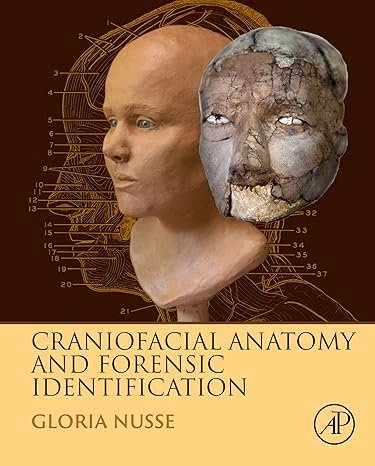 The Obscure Sacroiliac Joint: Insights into anatomy biomechanics etiology and the treatment of mechanical dysfunction