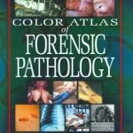Color Atlas Of Forensic Pathology 1st Edition