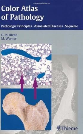 Color Atlas of Pathology: Pathologic Principles-Associated Diseases-Sequela 1st Edition
