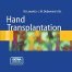 Hand transplantation