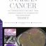 Ovarian Cancer: The “Gynaecological Challenge” from Diagnostic Work-Up to Cytoreduction and Chemotherapy. Volume 2